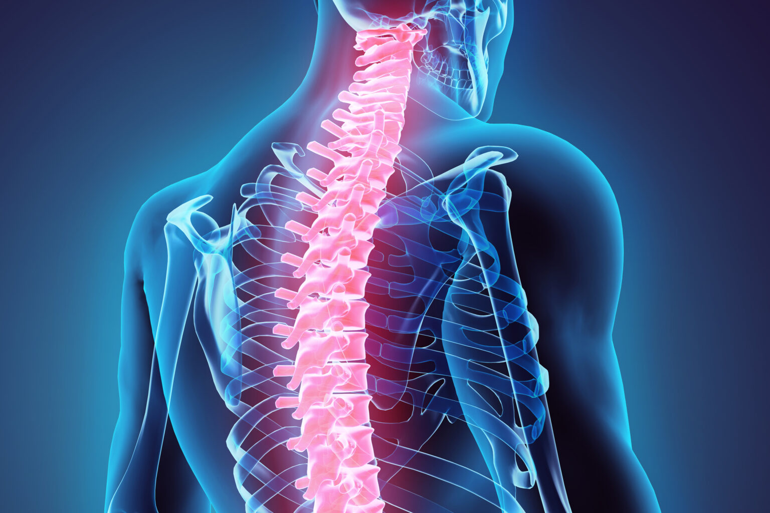 Muscle Relaxants for Back Pain? - Wellness Letter