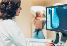 mammography screening