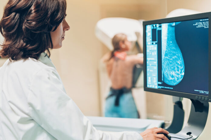 mammography screening