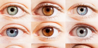 eye color
