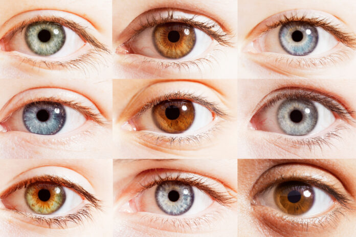 eye color