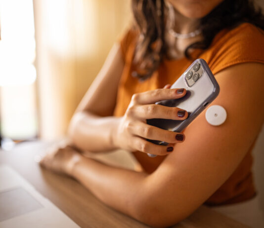 blood sugar monitoring