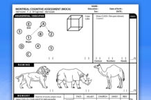 Cognitive Screening