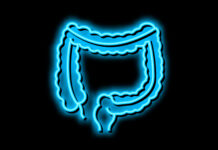 Colon Cancer Stool Tests