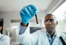 prostate cancer screening