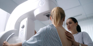 breast arterial calcification