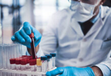 New Blood Tests for Alzheimer’s Alzheimer's blood test