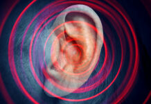laser therapy for tinnitus