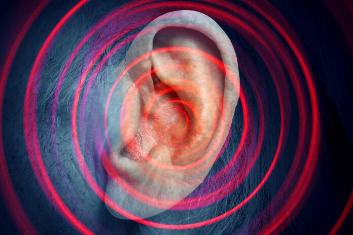 laser therapy for tinnitus