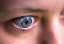 New Treatments for Thyroid Eye Disease thyroid eye disease