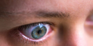 thyroid eye disease
